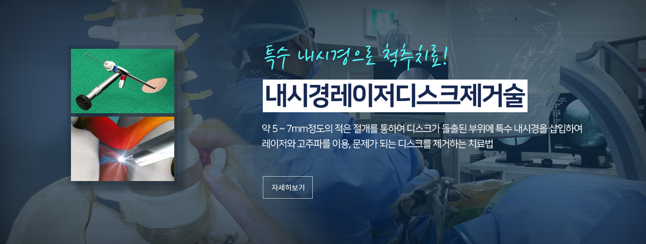 연세척 병원 내시경레이저디스크제거술